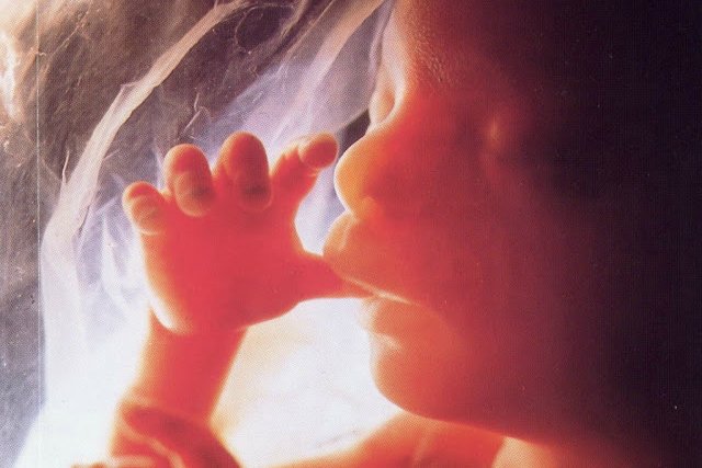 ژنتیک و سقط جنین