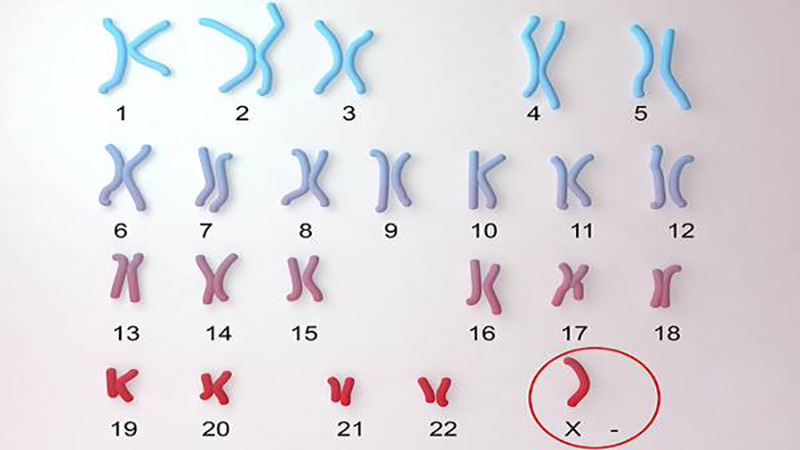 بهترین آزمایشگاه ژنتیک اصفهان | آزمایش کاریوتیپ