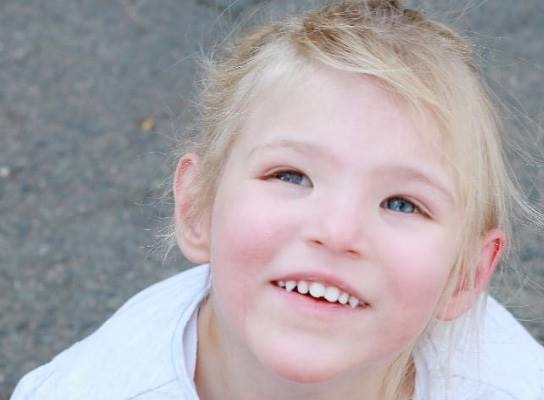 درمان سندروم صدای گربه و تشخیص آن | آزمایشگاه ژنتیک اصفهان