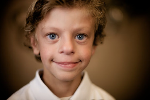 درمان سندرم ویلیامز-تشخیص و دلایل ابتلا به آن | آزمایشگاه ژنتیک اصفهان