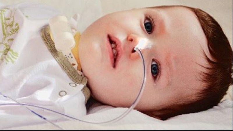 سندروم گلین باره در کودکان | آزمایشگاه ژنتیک اصفهان