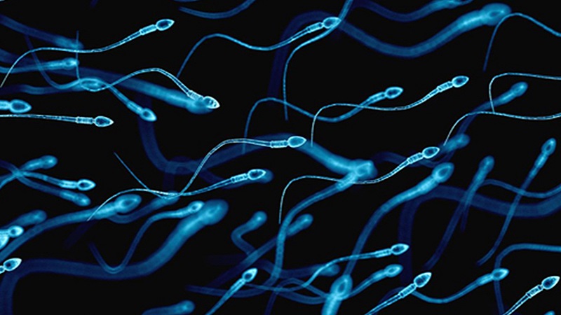 روش های پیشگیری و درمان آزواسپرمی | آزمایشگاه ژن آزما