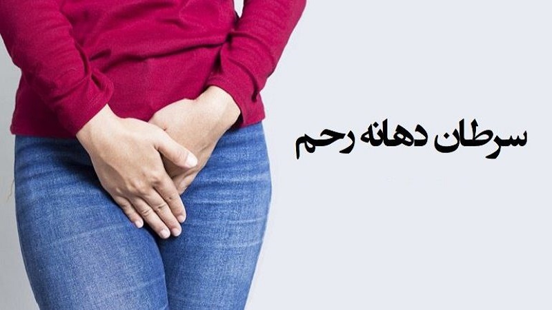علت سرطان دهانه رحم | آزمایشگاه ژن آزما