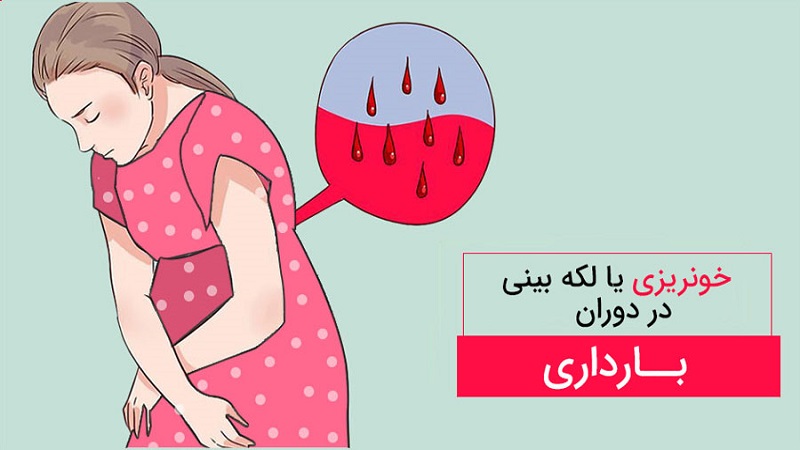 دلایل خونریزی زودهنگام در بارداری | آزمایشگاه ژنتیک اصفهان