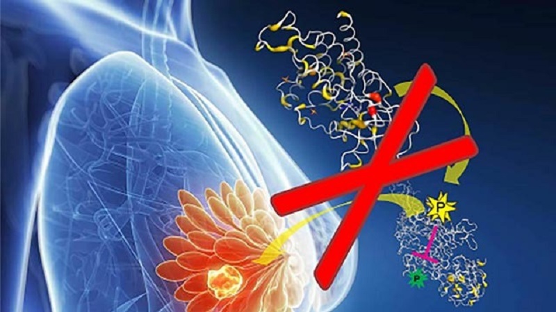 سرطان پستان و ژنتیک | آزمایشگاه ژنتیک اصفهان
