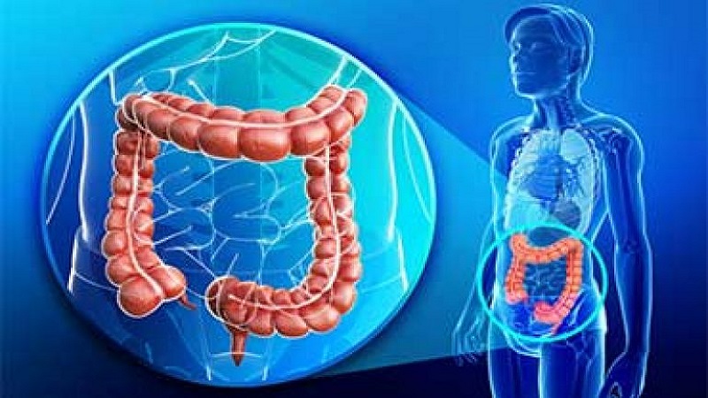 آزمایش های ژنتیکی و سرطان کولورکتال | بهترین آزمایشگاه ژنتیک اصفهان