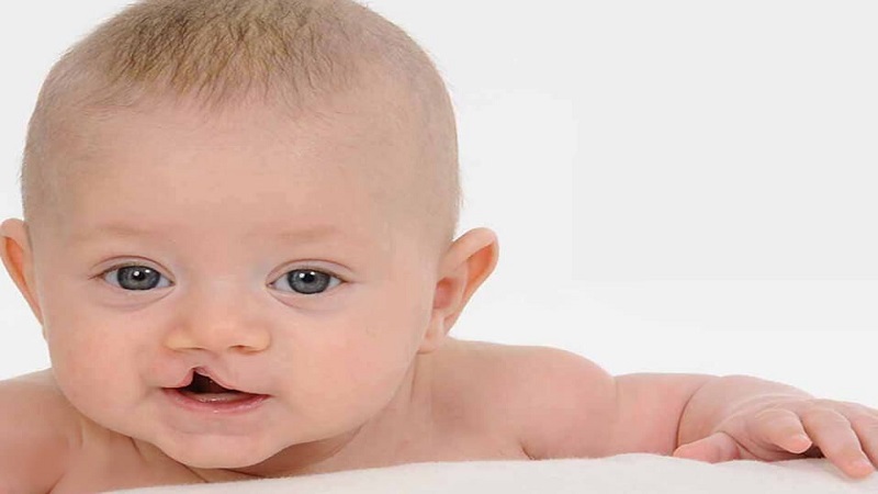 تشخیص و درمان سندرم پاتو | بهترین آزمایشگاه ژنتیک اصفهان