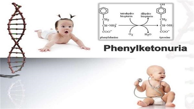 بیماری فنیل کتونوری یا PKU | آزمایش ژنتیک اصفهان