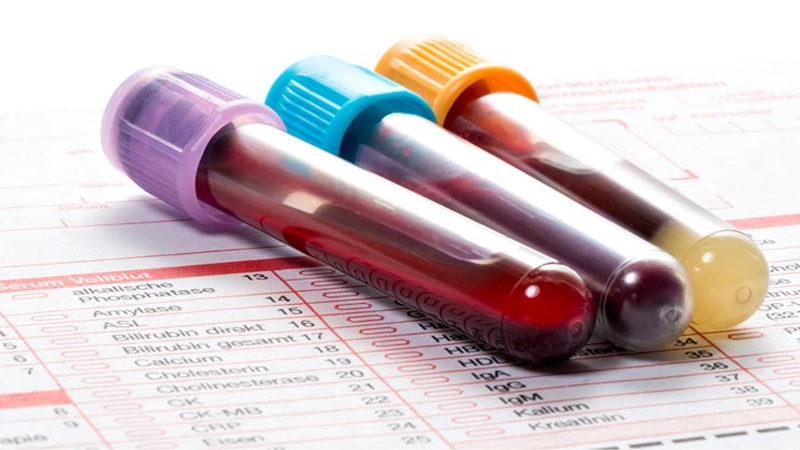 غربالگری ژنتیک | آزمایش ژنتیک اصفهان