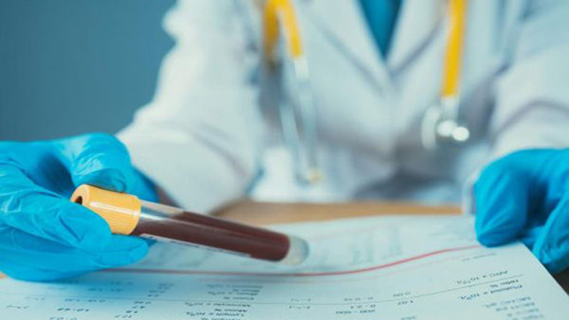 آنچه در مورد غربالگری ژنتیک باید بدانیم | آزمایش ژنتیک اصفهان