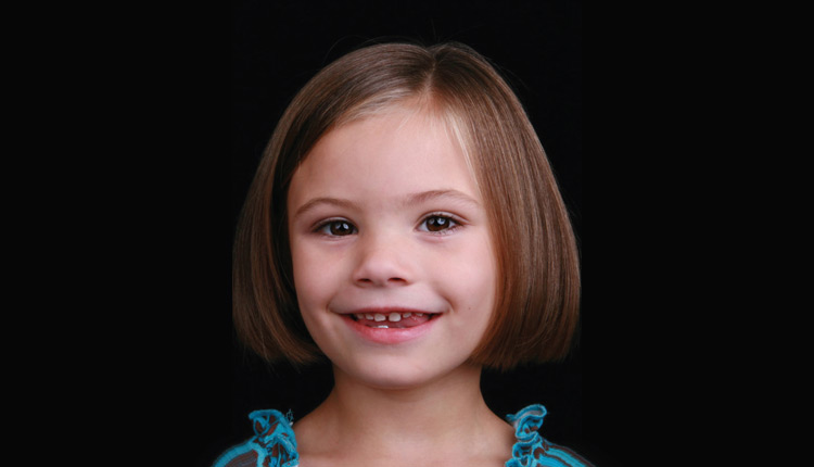 تشخیص سندرم الکل جنینی