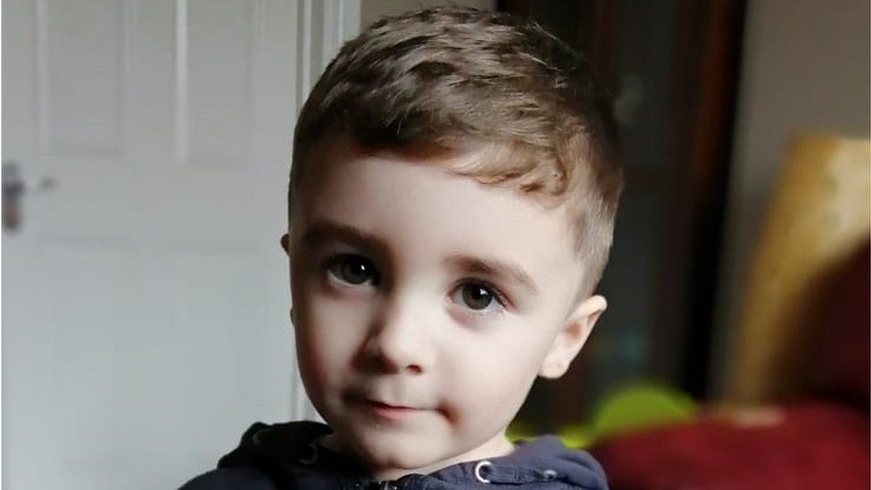 تشخیص سندرم الکل جنینی