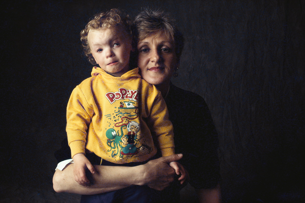 سندرم جنین الکلی چیست