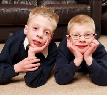 سندرم اسمیت لملی اپتیز