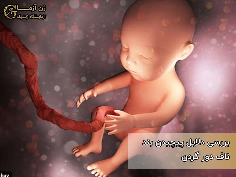 دلایل پیچیدن بند ناف دور گردن جنین