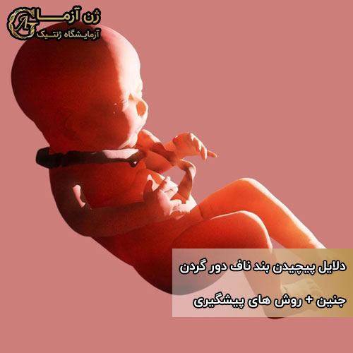 پیچیدن بند ناف دور گردن جنین