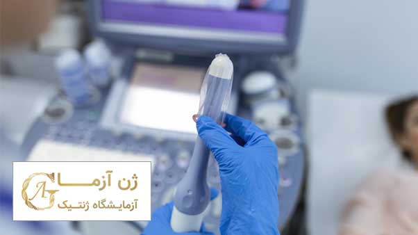 اهمیت آزمایش ژنتیک سرطان تخمدان | ژن آزما