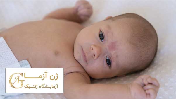 بیماری پوستی ژنتیکی در نوزادان | ژن آزما