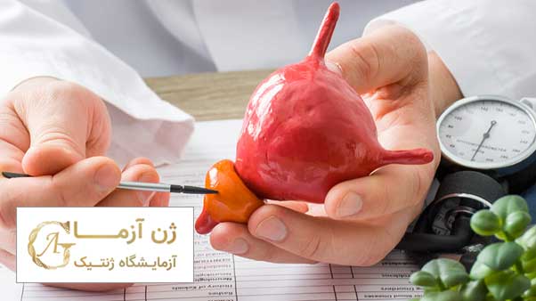 عامل اصلی بروز سرطان پروستات بدخیم ارثی | ژن آزما
