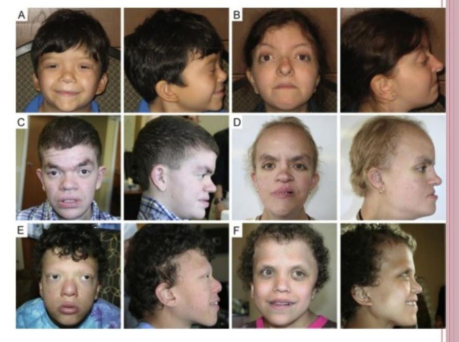 جلوگیری از اختلالات کروموزومی