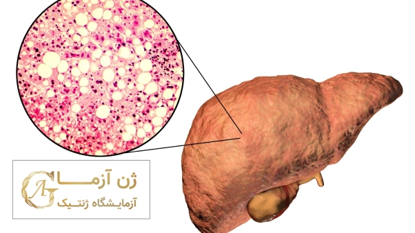 چه زمانی آزمایش ژنتیک سرطان کبد نیاز است؟ | ژن آزما