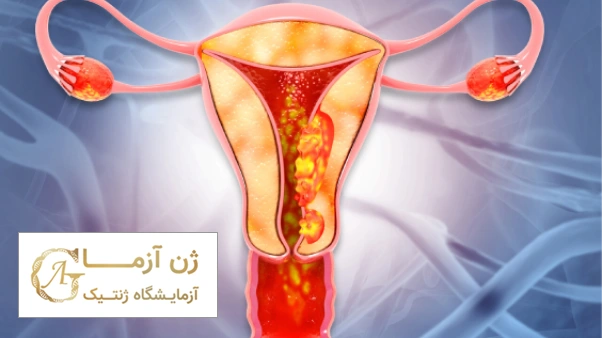 طول عمر بیماران سرطان رحم | آزمایشگاه ژن آزما