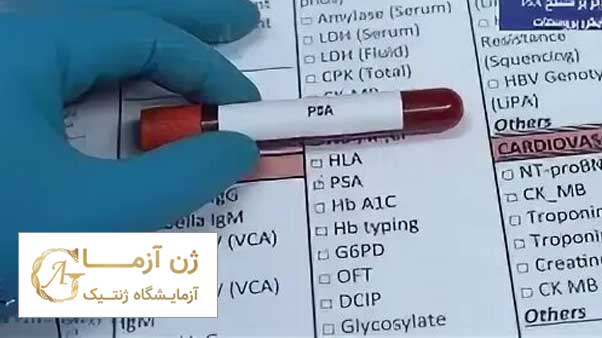 بهترین آزمایشگاه psa اصفهان کدام است ؟ | آزمایشگاه ژن آزما