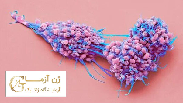 علائم سرطان تخمدان | ژن آزما