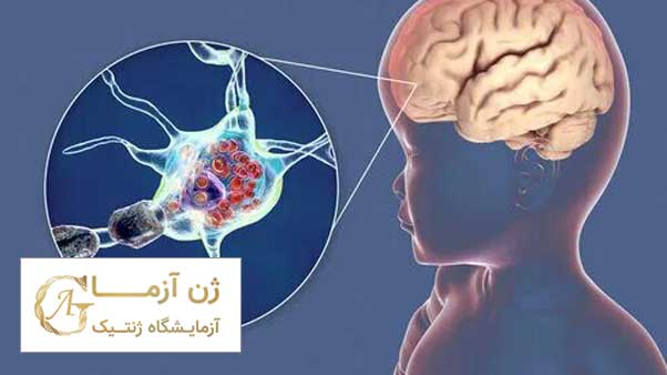 بیماری تای&zwnj;ساکس | ژن آزما