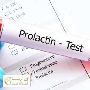 آزمایش پرولاکتین خون چیست
