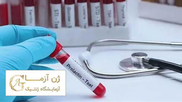 بهترین آزمایشگاه آزمایش پرولاکتین خون