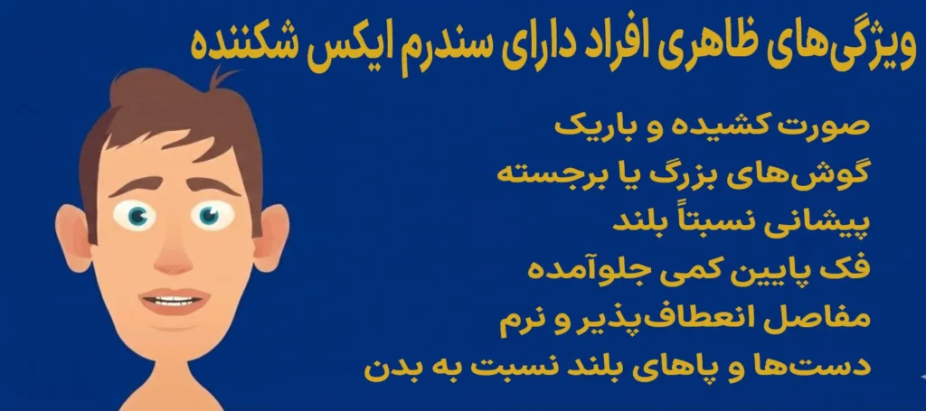 سندرم ایکس شکننده